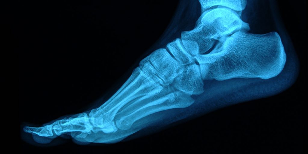 foot x-ray